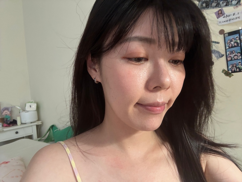 小岩井皮秒蜂巢雷射心得｜改善毛孔粗大有效嗎？膚色亮白 + 保濕導入分享